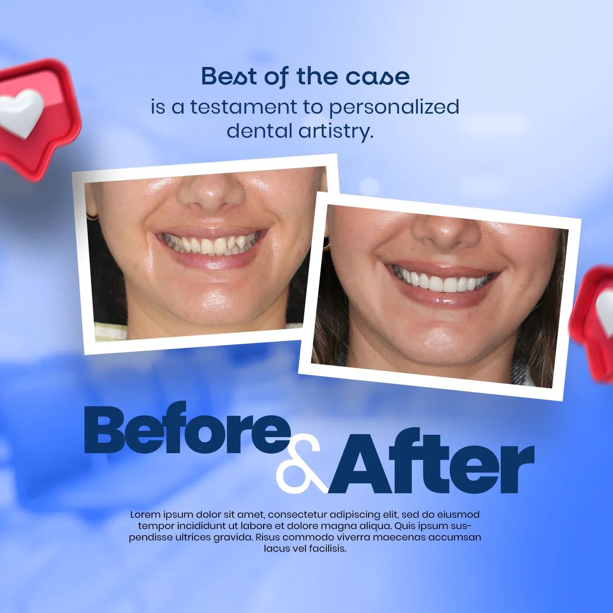 Before After Dental Results